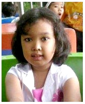 Rafifah Aliefa Putri 03 MRI.jpg